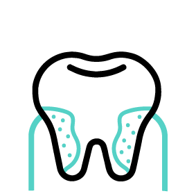 Icon for Periodontal Treatment in West Palm Beach