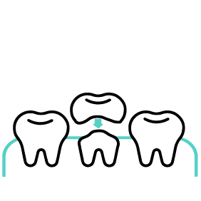 Icon for Restorative Dentistry in West Palm Beach